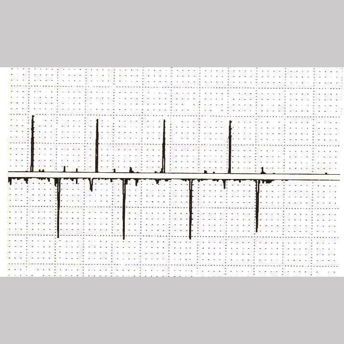 chart horus 5002 eitop emi drill pipe ndt inspection tubular horus 5002 octg asnt tc 1a training certification drilling refacing bha coil buggy electromagnetic inspection horus 5001 horus 5003 emi